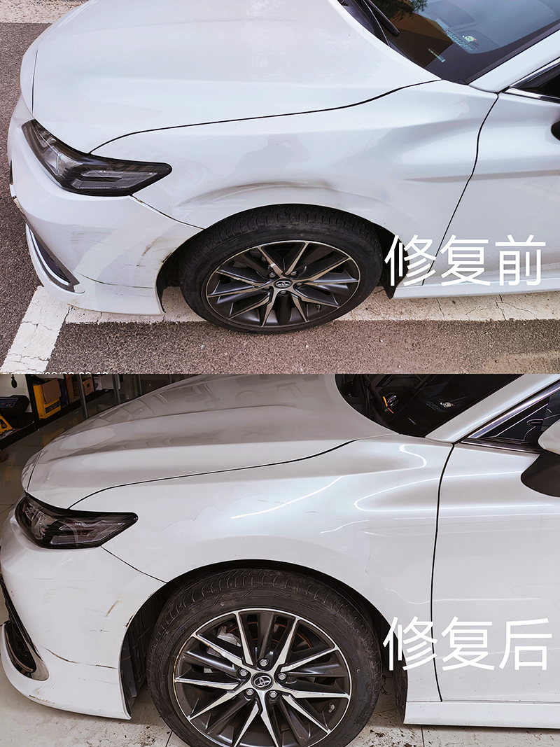 丰田凹陷修复案例