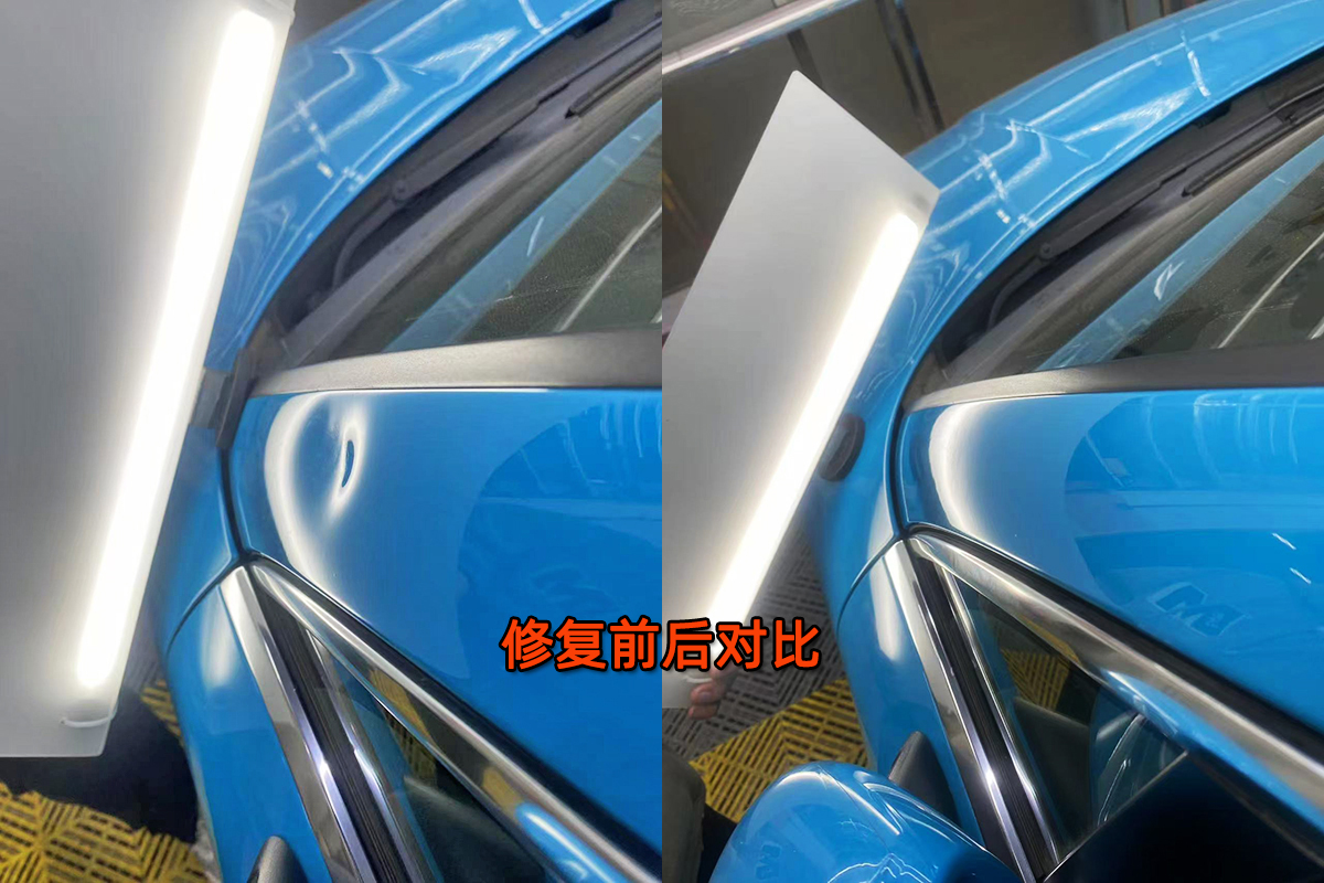A柱凹陷修复案例
